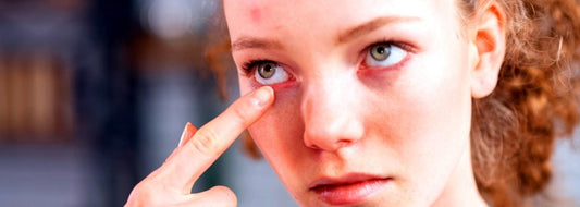 Are There Any Downsides to Lash Extensions? | SNOB